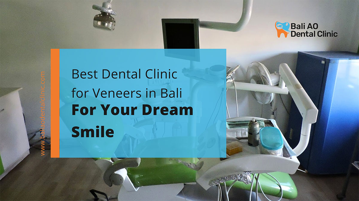 best dental clinic for veneers