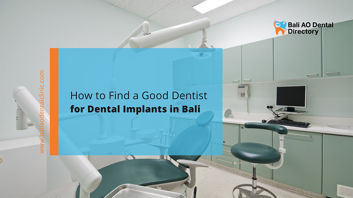 Good Dentist for Dental Implants