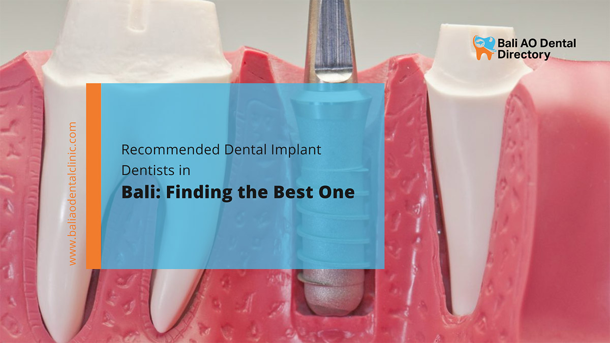 Recommended Dental Implant Dentists