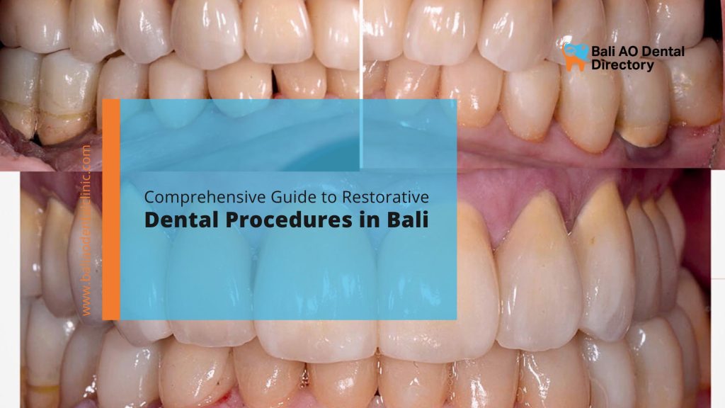 restorative dental procedures