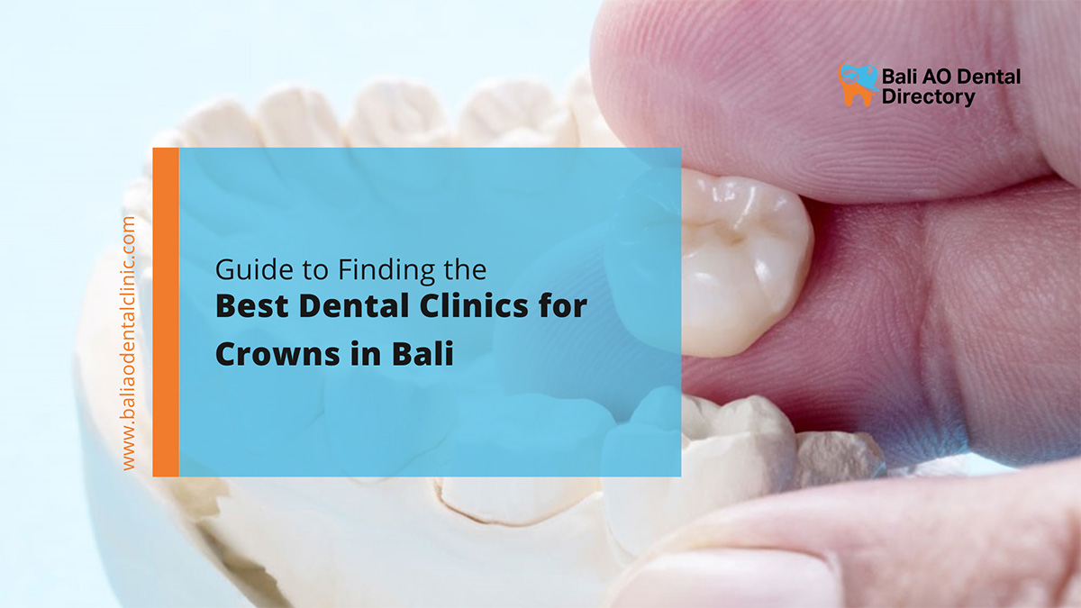 best dental clinics for crowns in bali