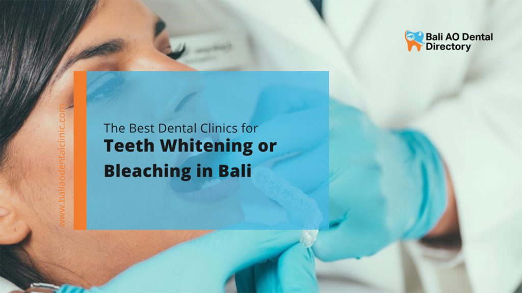 do all dentists do teeth whitening